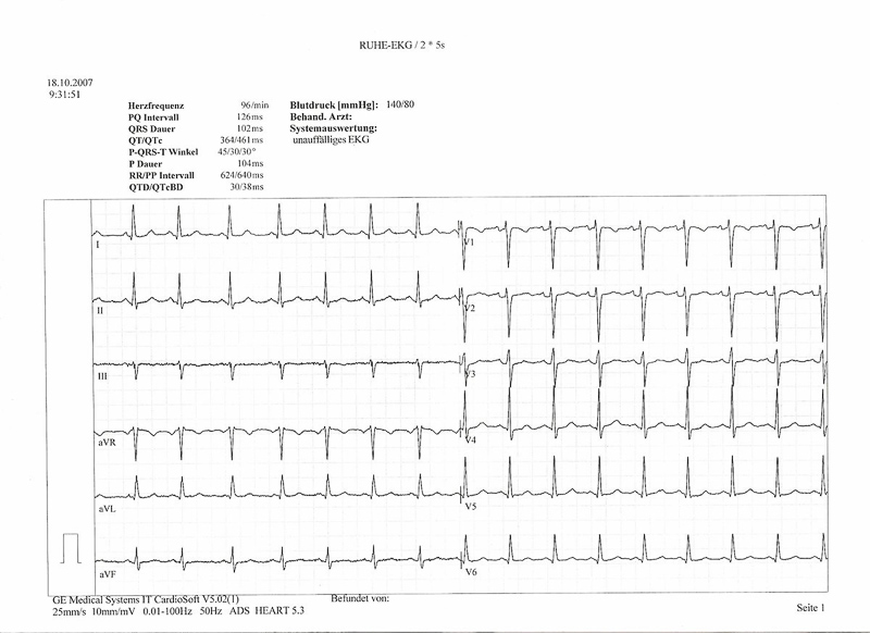 Elektrokardiogramm
