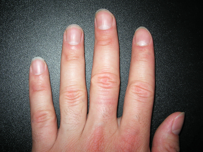 Fingernagel Definition And Synonyms Of Fingernagel In The German Dictionary