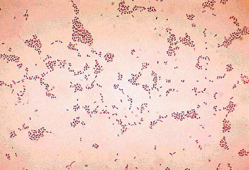 actinobacillus