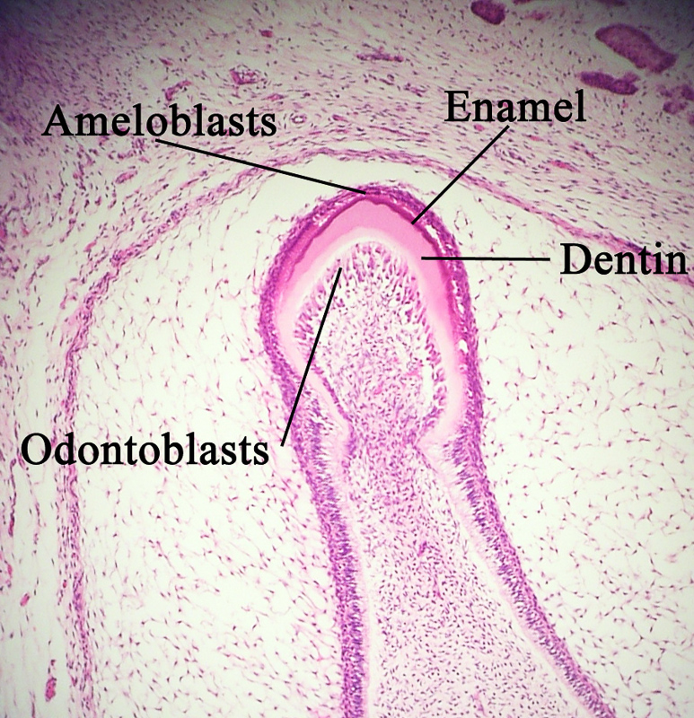 ameloblast