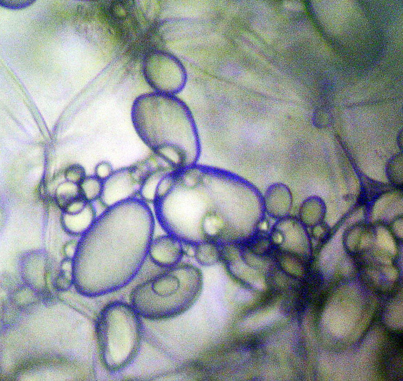 amyloplast