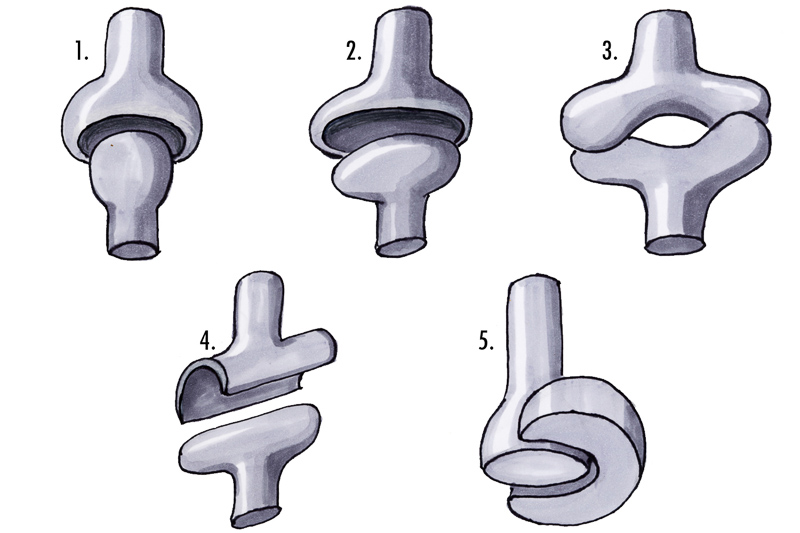 ball-and-socket joint