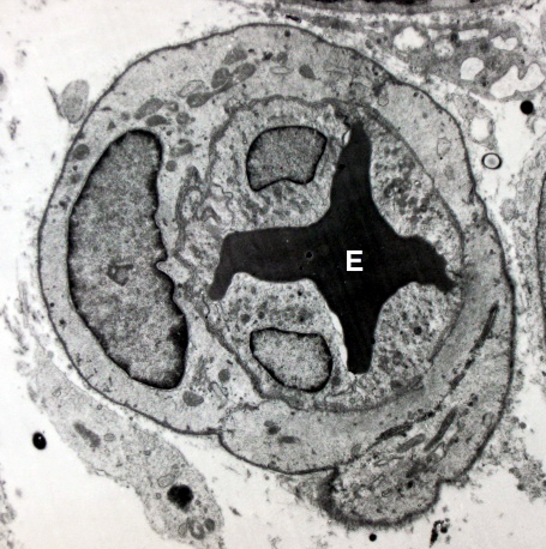 endothelia