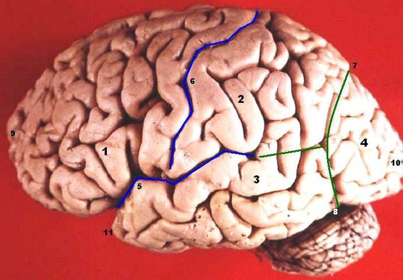 central sulcus