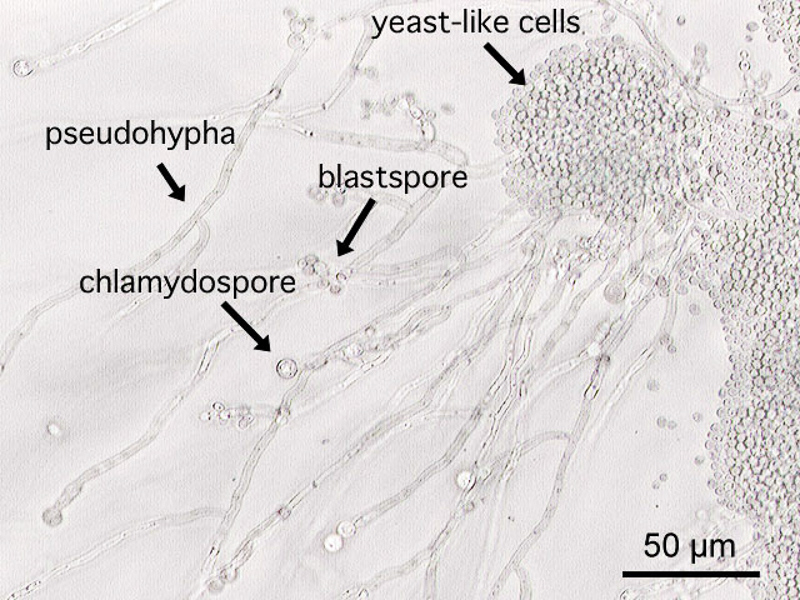 chlamydospore