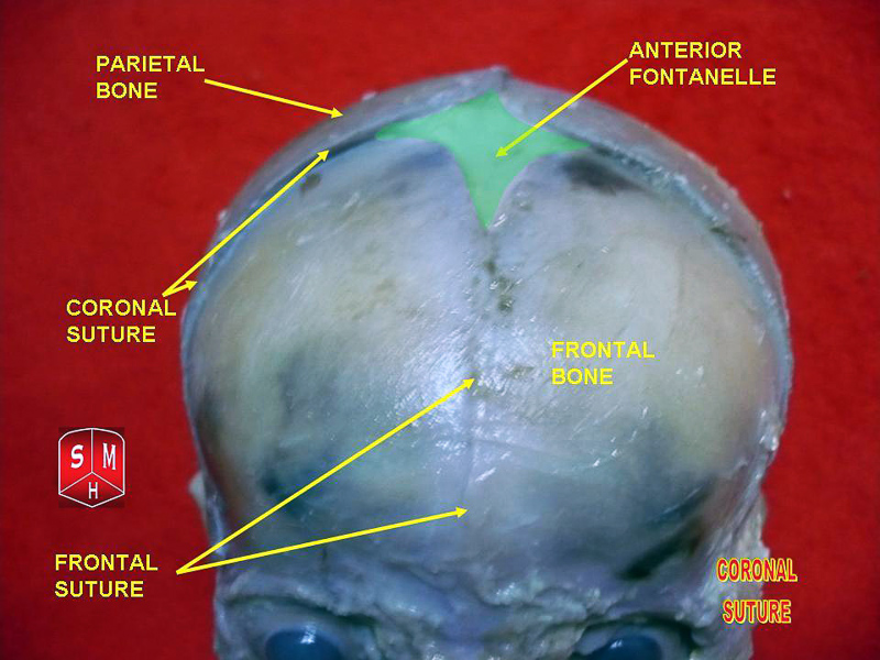 coronal suture