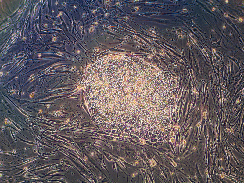 human embryonic stem cell