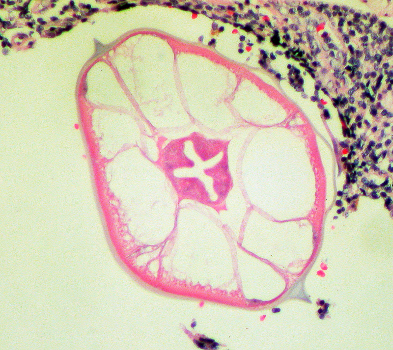 a körömférgek tünetei a felnőttek kezelésében pinwormok mérete