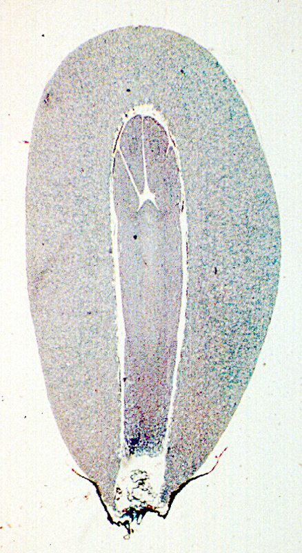 megagametophyte