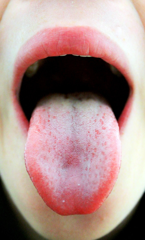 tongueless