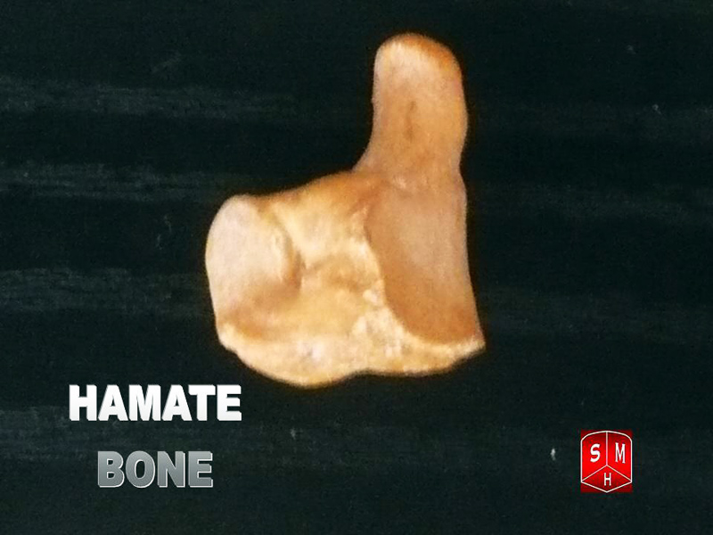 unciform bone