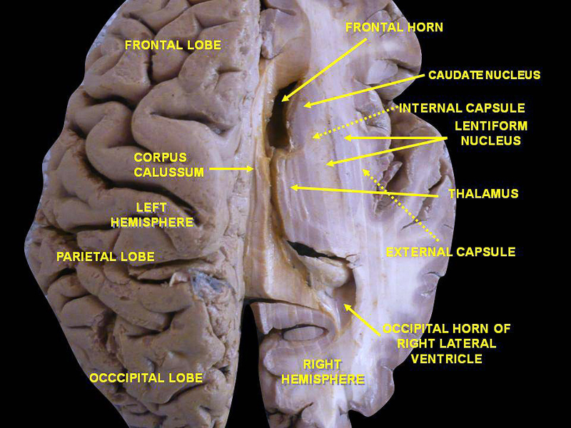 left brain