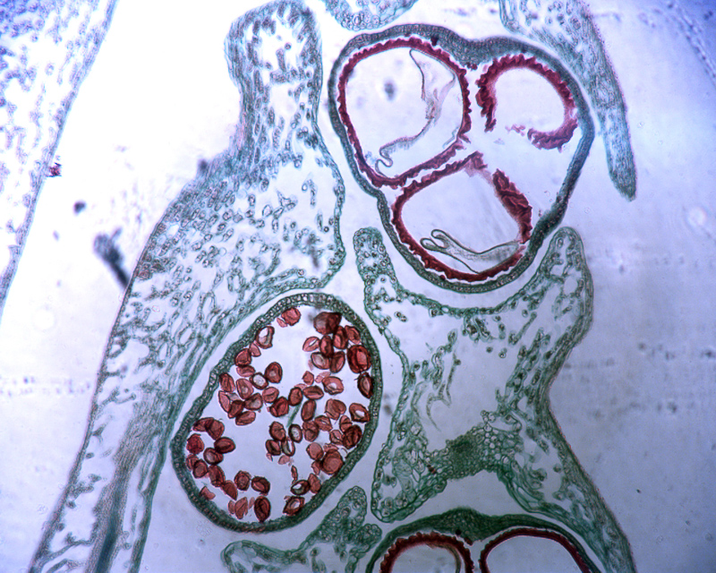 microspore