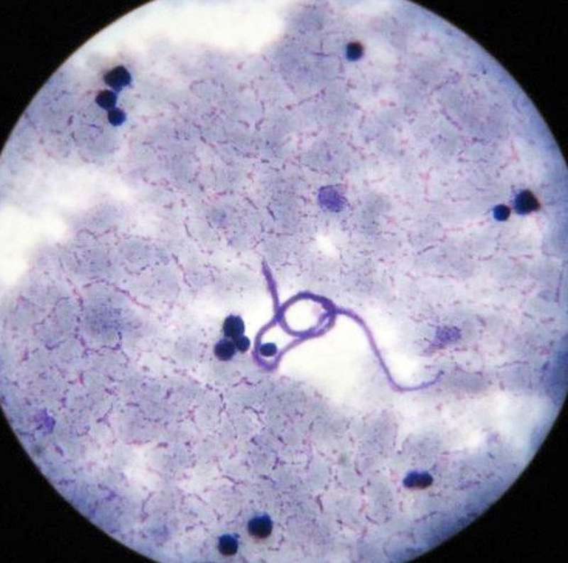 microfilariae