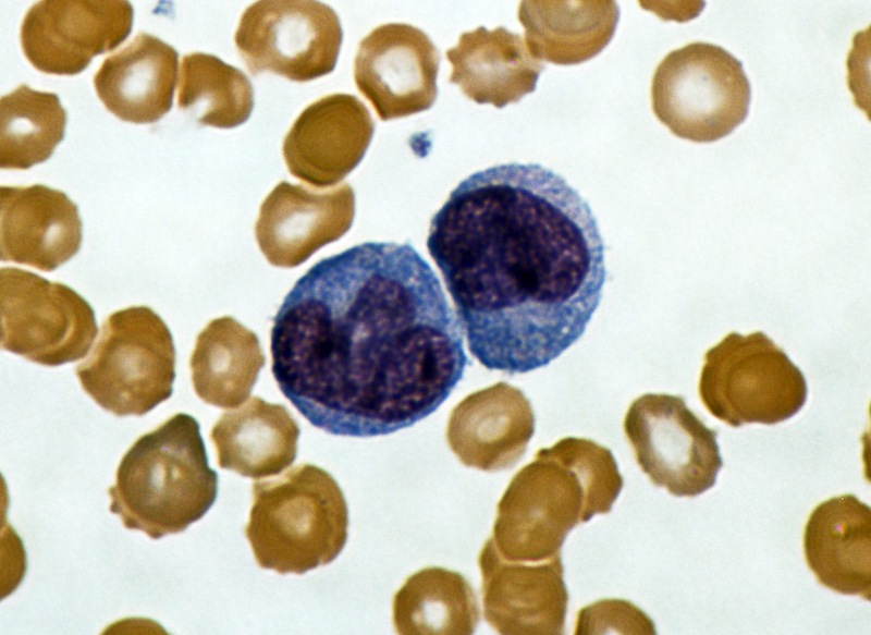 monocyte