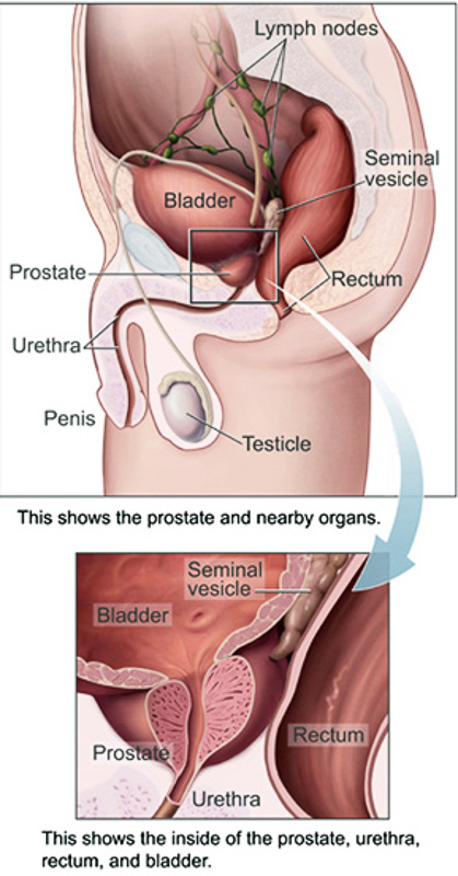 Prostatita urologie istoric medical
