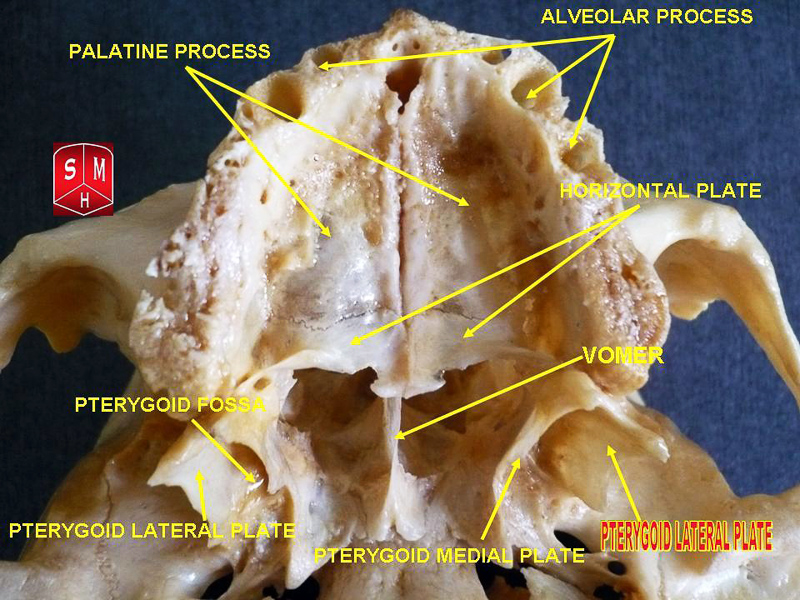 pterygoid process