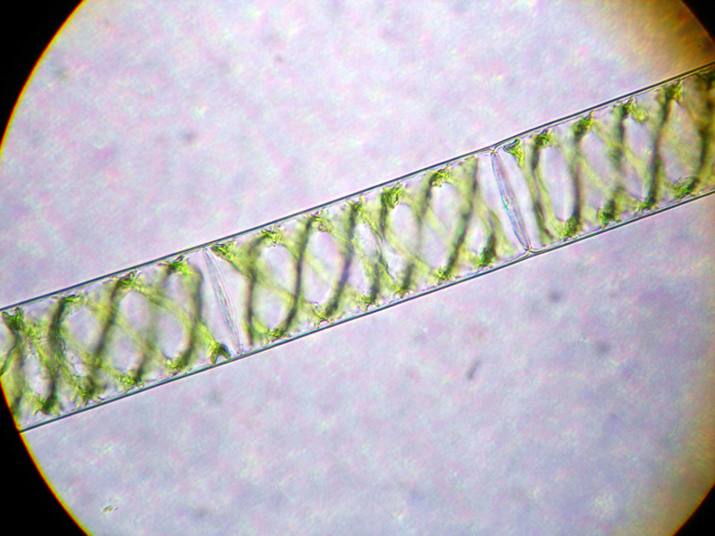 spirogyra