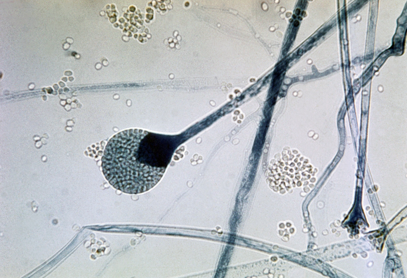 sporangiospore