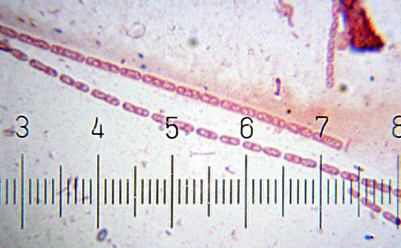 streptobacillus