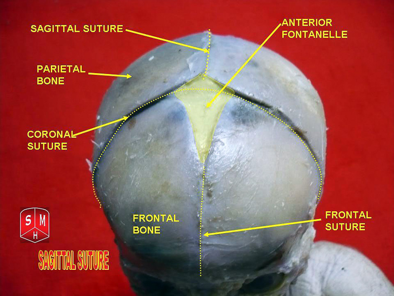 cranial suture