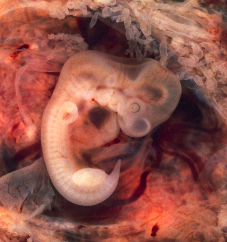 embrionario