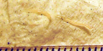 enterobius vermicularis oxiuro)