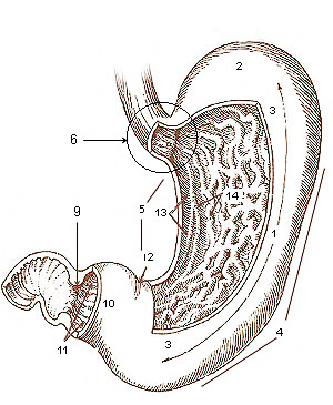 gastrectomía