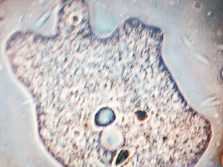 protozoario