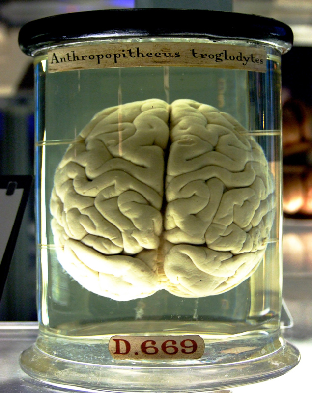 cérébral