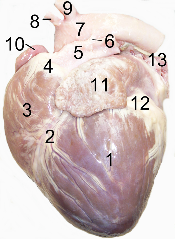 cardiaque
