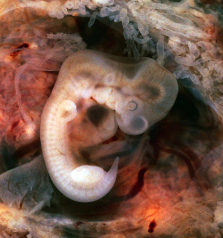 embryologique