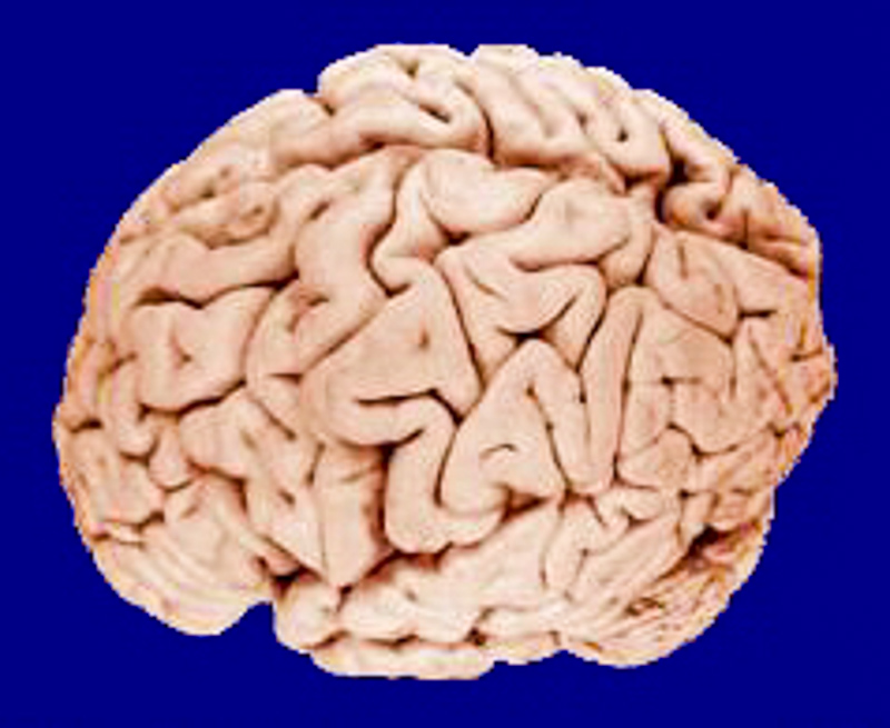 दिमाग