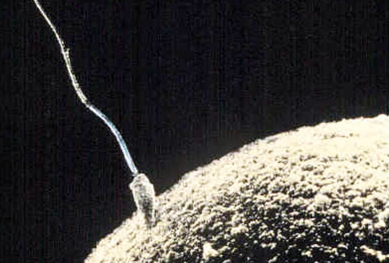 spermatozoo