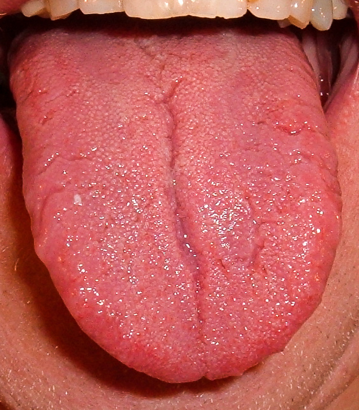 혀