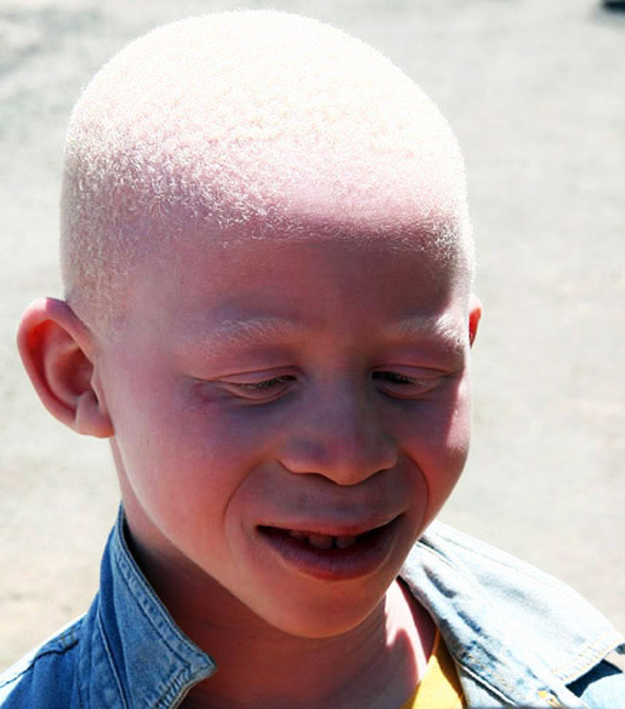 albinia