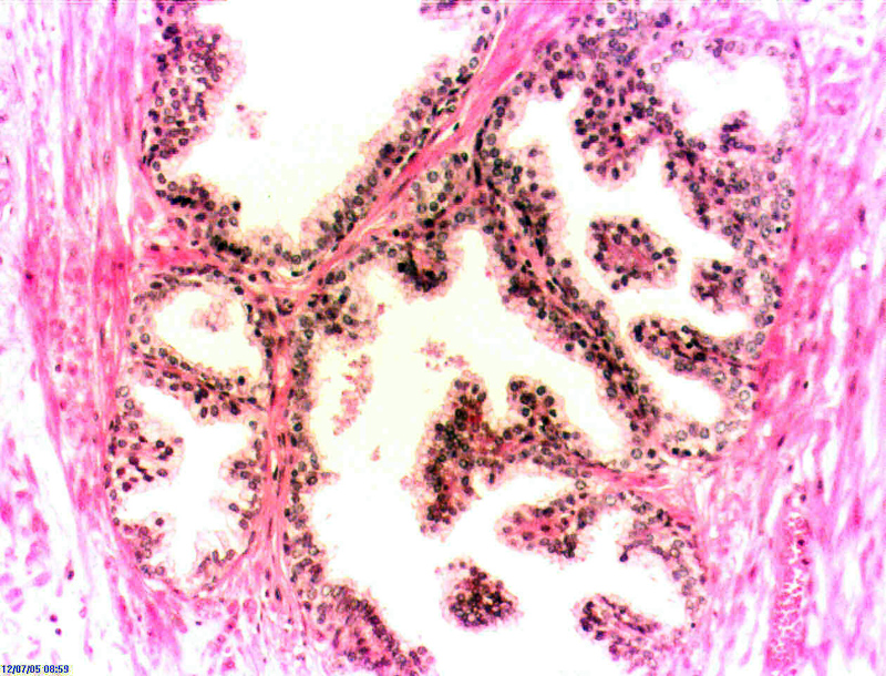 micróglia