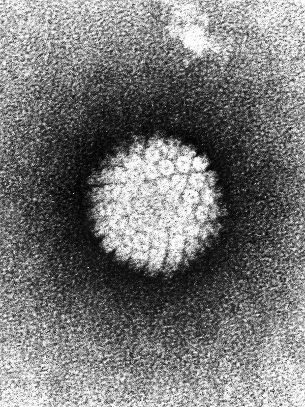 humán papillomavírus def vastagbél méregtelenítő uk